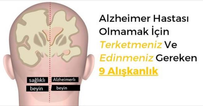 Alzheimer Hastalığını Önlemek İçin Yapmanız ve Yapmamanız Gereken 9 Şey